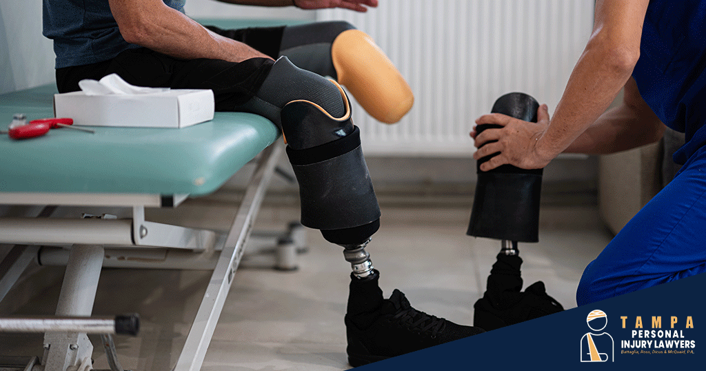 Tampa Amputation Injury Attorneys